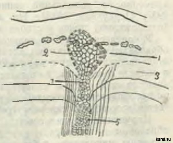 Карельская береза. Поперечное сечение побега. Каллюс в коре: 1 — пробковый слой (феллем); 2 — паренхима; 3 — луб: 4—след каллюса; 5 — каллюс в древесине.